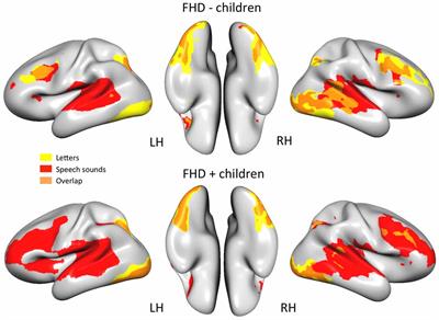 Letter and Speech Sound Association in Emerging Readers With Familial Risk of Dyslexia